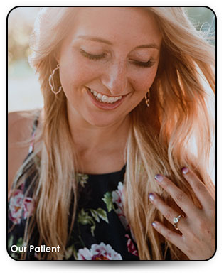 clear aligners