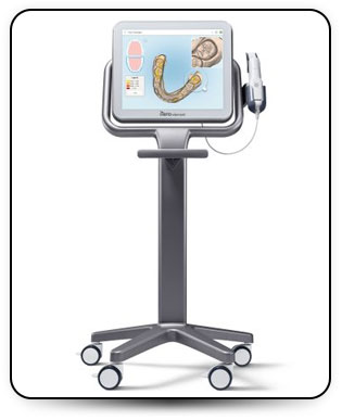 itero digital scanner