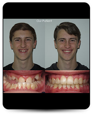 surgical orthodontics